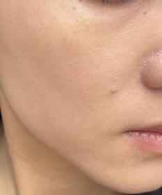 Rin-Benefit反孔精英無PORE粉底_3