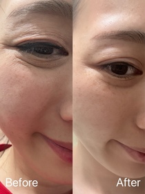 TingKiss-MENTHOLATUM 曼秀雷敦三重胜肽祛紋緊緻眼膜_3