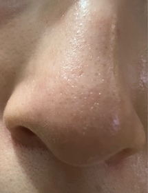 Anita-CeraVeA醇全效平滑祛印精華_1