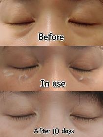 Mimizai-JONZAC緊緻祛暗眼唇精華_3