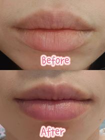 Mimizai-JONZAC緊緻祛暗眼唇精華_4