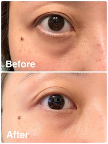 Meric-JONZAC緊緻祛暗眼唇精華_1