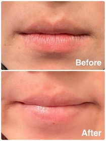 Meric-JONZAC緊緻祛暗眼唇精華_2