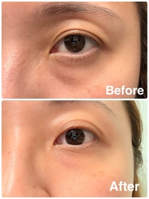 Meric-JONZAC緊緻祛暗眼唇精華_3