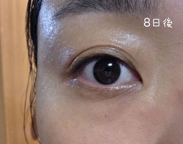joycefyt-JONZAC緊緻祛暗眼唇精華_3