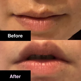 winniemaow-JONZAC緊緻祛暗眼唇精華_4