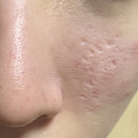 YY-LA ROCHE-POSAYCICAPLAST B5萬用修復霜_1