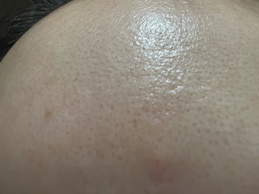 Anita-CeraVe去油抗瑕疵白泥潔膚露_1