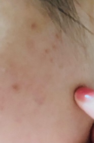 jas2468f-CeraVe去油抗瑕疵白泥潔膚露_3