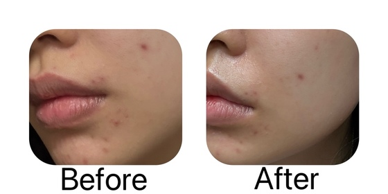 deadblue-CeraVe去油抗瑕疵白泥潔膚露_2