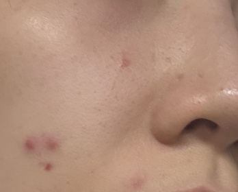 deadblue-CeraVeA醇全效平滑祛印精華_1