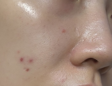 deadblue-CeraVeA醇全效平滑祛印精華_2