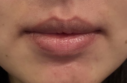 Kmggigi-MENTHOLATUM 曼秀雷敦薄荷潤唇膏_3