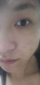 Niki Yau-JONZAC緊緻祛暗眼唇精華_4