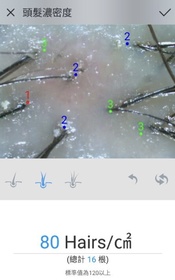 alicec-L'Occitane en Provence草本療法防掉髮頭皮護理精華_1