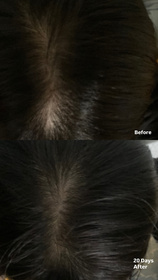 alicec-L'Occitane en Provence草本療法防掉髮頭皮護理精華_2