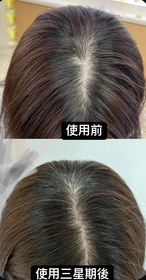 sscxy-L'Occitane en Provence草本療法防掉髮頭皮護理精華_4