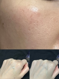 Sccan-L'ORÉAL PARiS活力緊緻透明質酸充盈導入霜_1