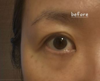 Woy-La Colline活細胞眼部美化膜_2