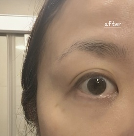 Woy-La Colline活細胞眼部美化膜_3