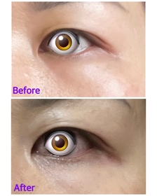 Iris0148-La Colline活細胞眼部美化膜_4