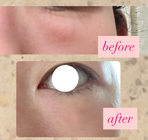 nicolebuzz-La Colline活細胞眼部美化膜_2