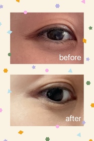 olitong-La Colline活細胞眼部美化膜_1