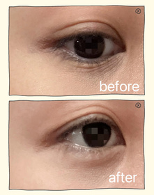 olitong-La Colline活細胞眼部緊緻精華_4