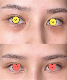Fng-La Colline活細胞眼部美化膜_2