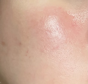 lingbb-d program酵母益生元柔膚水 (零毛孔)_4