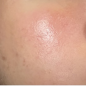 lingbb-MedicubeZERO果酸全效毛孔面霜_3