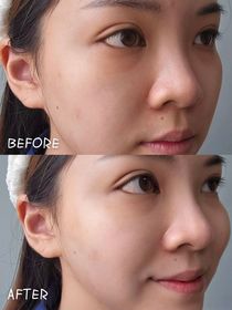 💕車車💕-SOFINA iP水光去角質碳酸慕絲精華_3