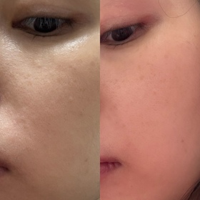 k-SOFINA iP水光去角質碳酸慕絲精華_2