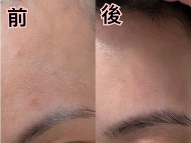 Yan-SOFINA iP水光去角質碳酸慕絲精華_1