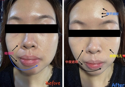 water1106-Benefit反孔精英無PORE粉底_2