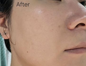 jessica94-SOFINA iP水光去角質碳酸慕絲精華_4