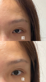 Kellyleeeeeee-SOFINA iP水光去角質碳酸慕絲精華_3