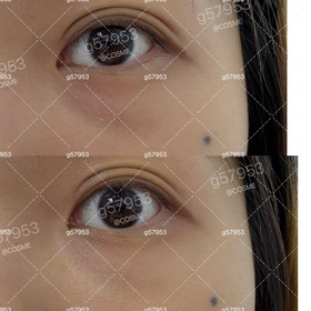 g57953-La Colline活細胞眼部緊緻精華_1