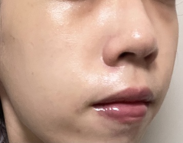 Kk.ac-AHC瞬效保濕B5微導入活膚霜_4