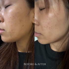 Coyee C.-QOLLABS納米亮肌維他命C粉 (高效持久) 15日分_4