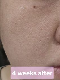 lovemon222-QOLLABS納米亮肌維他命C粉 (高效持久) 15日分_3