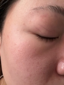 Zoe-QOLLABS納米亮肌維他命C粉 (高效持久) 15日分_1