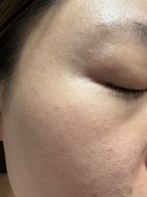 Zoe-QOLLABS納米亮肌維他命C粉 (高效持久) 15日分_2