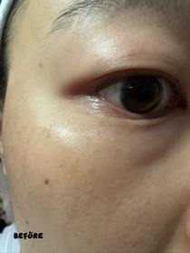 Shirlin Ho-HADA LABO 肌研Premium煥活抗皺滋養眼霜_1