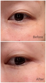 Clovercc-HADA LABO 肌研Premium煥活抗皺滋養眼霜_1