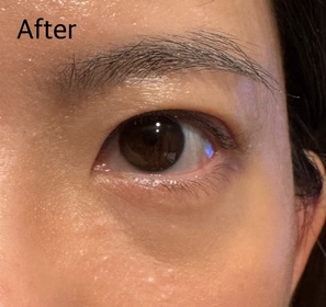 TT-HADA LABO 肌研Premium煥活抗皺滋養眼霜_2