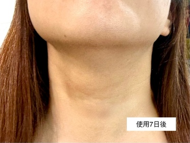 alice-Atorrege AD+速效保濕噴霧_3