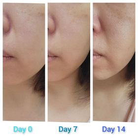 BoBo-Atorrege AD+深層保濕精華 (水繃帶)_3