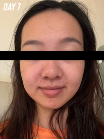 Kmggigi-Atorrege AD+深層保濕精華 (水繃帶)_2