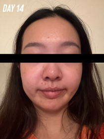 Kmggigi-Atorrege AD+深層保濕精華 (水繃帶)_4